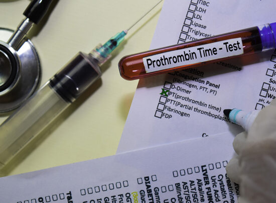 The prothrombin time Test Homestead Community Health Center